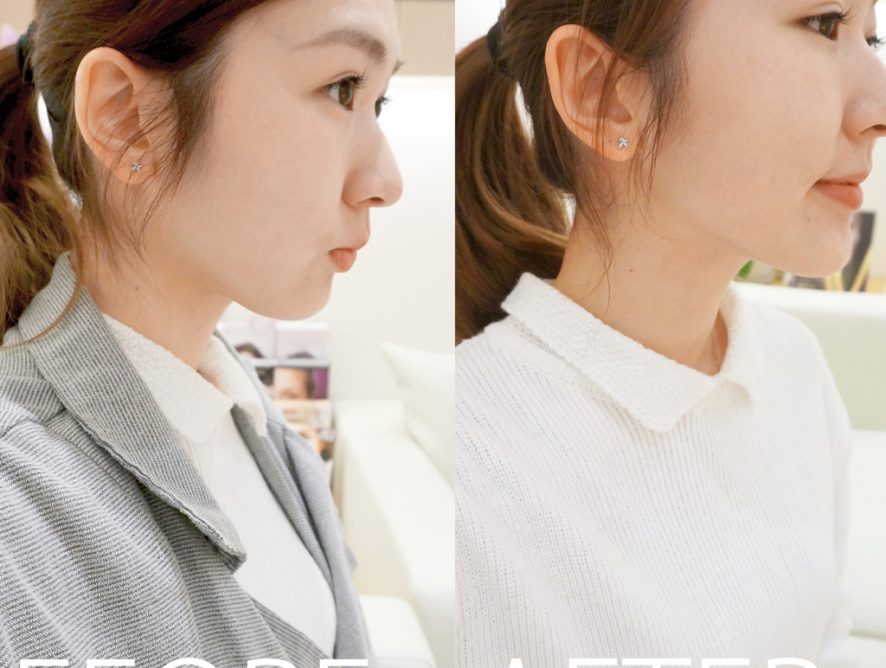 1 (13)